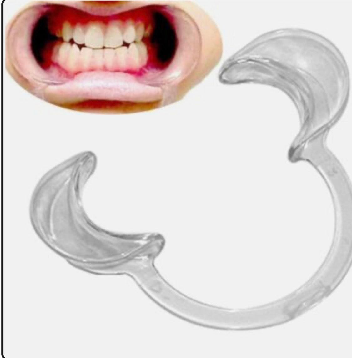 Teeth Whitening Cheek Retractor